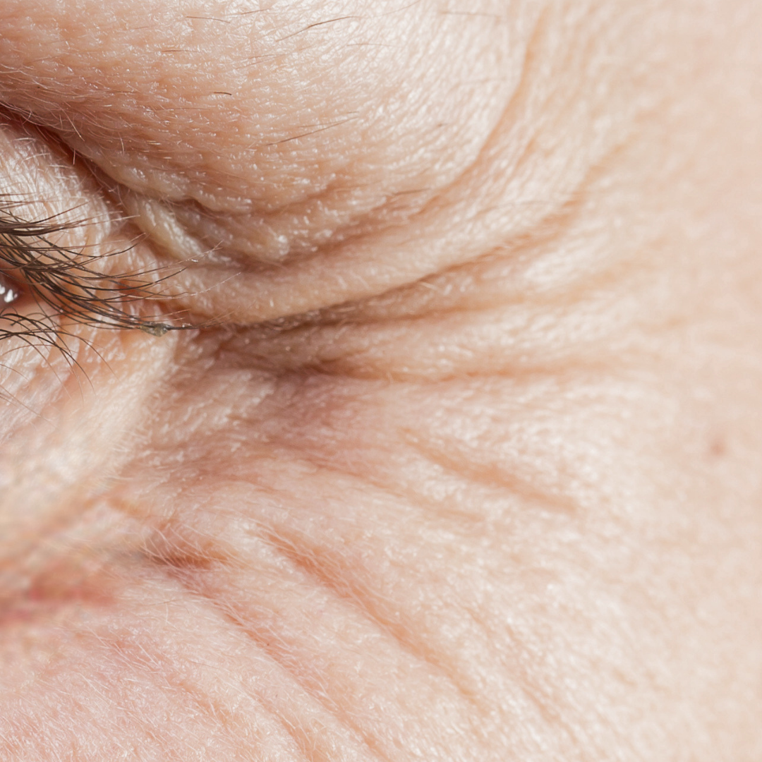 Anti-Aging & Falten